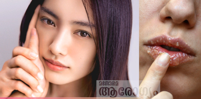 lips5435